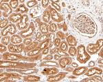 AMPK alpha-2 Antibody in Immunohistochemistry (Paraffin) (IHC (P))