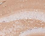 AMPK alpha-2 Antibody in Immunohistochemistry (Paraffin) (IHC (P))