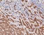 A2M Antibody in Immunohistochemistry (Paraffin) (IHC (P))