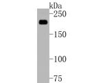 A2M Antibody in Western Blot (WB)