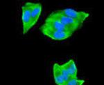 PTP1B Antibody in Immunocytochemistry (ICC/IF)