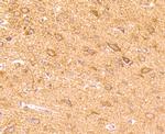 CD137 (4-1BB) Antibody in Immunohistochemistry (Paraffin) (IHC (P))