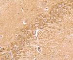 CD137 (4-1BB) Antibody in Immunohistochemistry (Paraffin) (IHC (P))