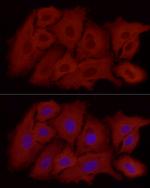 ALDH1A1 Antibody in Immunocytochemistry (ICC/IF)