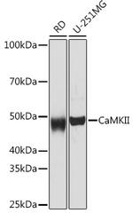 CaMKII pan Antibody in Western Blot (WB)