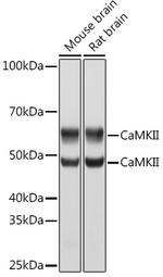 CaMKII pan Antibody in Western Blot (WB)