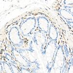 QKI Antibody in Immunohistochemistry (Paraffin) (IHC (P))