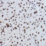 EXOSC7 Antibody in Immunohistochemistry (Paraffin) (IHC (P))