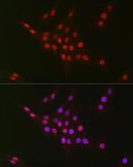 CtBP2 Antibody in Immunocytochemistry (ICC/IF)