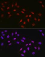 CtBP2 Antibody in Immunocytochemistry (ICC/IF)