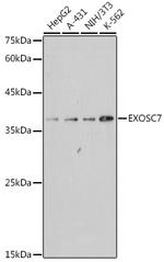 EXOSC7 Antibody in Western Blot (WB)