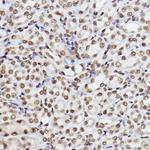 UBE2B Antibody in Immunohistochemistry (Paraffin) (IHC (P))