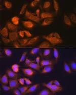 HK1 Antibody in Immunocytochemistry (ICC/IF)