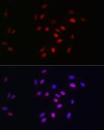 HDGF Antibody in Immunocytochemistry (ICC/IF)