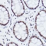 MED4 Antibody in Immunohistochemistry (Paraffin) (IHC (P))