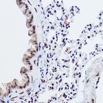 MED4 Antibody in Immunohistochemistry (Paraffin) (IHC (P))