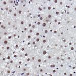 MED4 Antibody in Immunohistochemistry (Paraffin) (IHC (P))