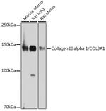 Collagen III Antibody in Western Blot (WB)