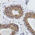 MGST1 Antibody in Immunohistochemistry (Paraffin) (IHC (P))