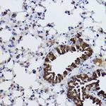 MGST1 Antibody in Immunohistochemistry (Paraffin) (IHC (P))