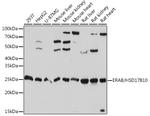 ERAB Antibody in Western Blot (WB)