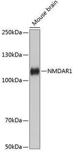 NMDAR1 Antibody in Western Blot (WB)