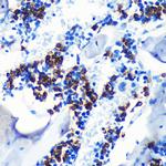 S100A8 Antibody in Immunohistochemistry (Paraffin) (IHC (P))