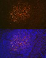 CD21 Antibody in Immunohistochemistry (Paraffin) (IHC (P))