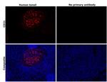 CD21 Antibody in Immunohistochemistry (Paraffin) (IHC (P))