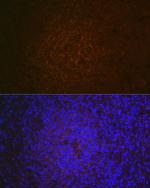 CD21 Antibody in Immunohistochemistry (Paraffin) (IHC (P))