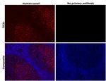 CD21 Antibody in Immunohistochemistry (Paraffin) (IHC (P))