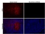 CD21 Antibody in Immunohistochemistry (Paraffin) (IHC (P))