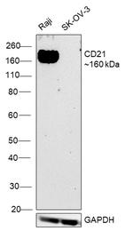 CD21 Antibody in Western Blot (WB)