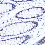 BRD4 Antibody in Immunohistochemistry (Paraffin) (IHC (P))