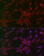 ARPC2 Antibody in Immunocytochemistry (ICC/IF)