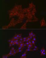 ARPC2 Antibody in Immunocytochemistry (ICC/IF)