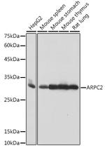 ARPC2 Antibody in Western Blot (WB)