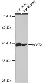 ACAT2 Antibody in Western Blot (WB)