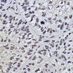 PDCD7 Antibody in Immunohistochemistry (Paraffin) (IHC (P))