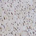 PDCD7 Antibody in Immunohistochemistry (Paraffin) (IHC (P))