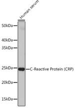 CRP Antibody in Western Blot (WB)