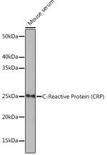 CRP Antibody in Western Blot (WB)