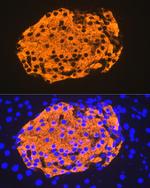 Insulin Antibody in Immunohistochemistry (Paraffin) (IHC (P))