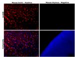 S100B Antibody in Immunohistochemistry (Paraffin) (IHC (P))