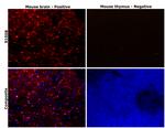 S100B Antibody