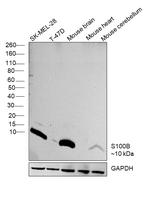 S100B Antibody