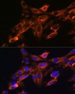 SRC Antibody in Immunocytochemistry (ICC/IF)