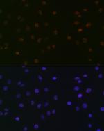 SPT5 Antibody in Immunocytochemistry (ICC/IF)