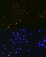 SPT5 Antibody in Immunocytochemistry (ICC/IF)