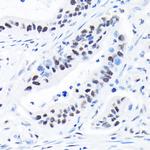 SPT5 Antibody in Immunohistochemistry (Paraffin) (IHC (P))